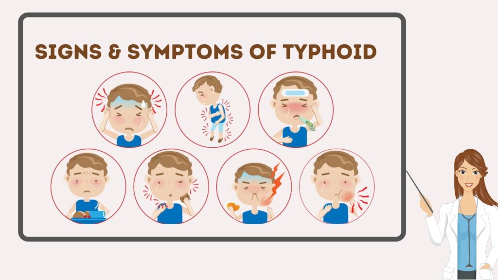 clinical-features-typhoid-fever