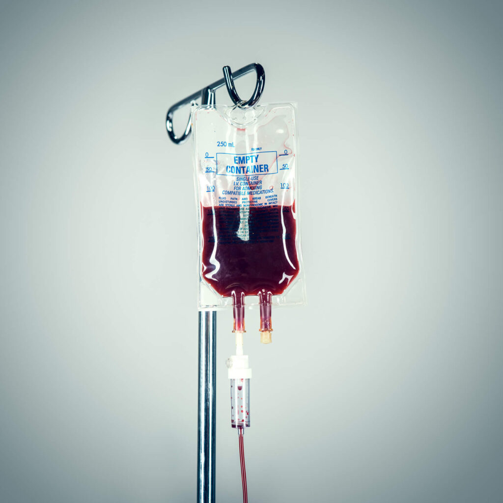 red blood cell transfusion