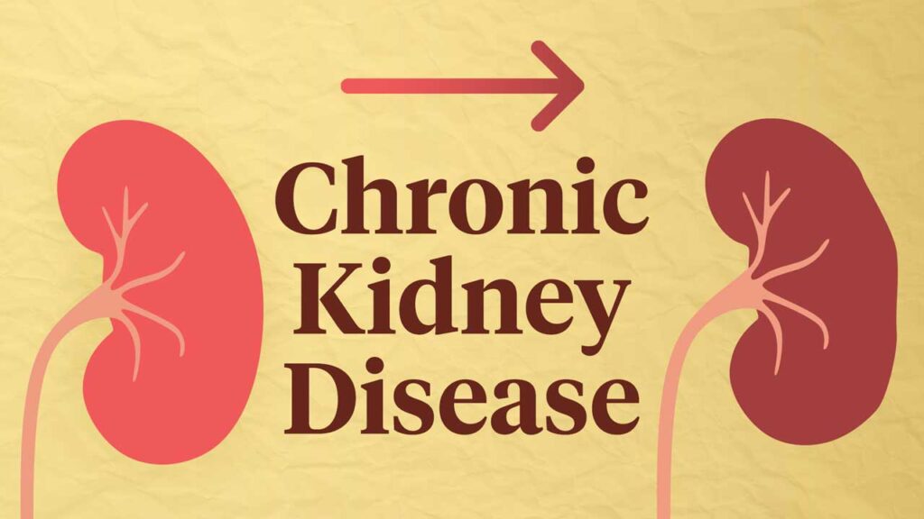 chronic-kidney-disease