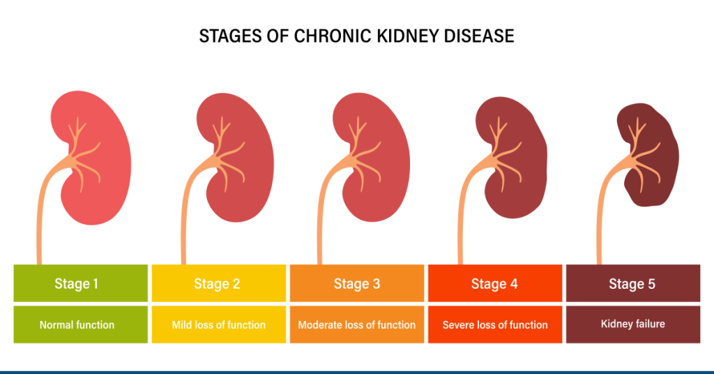 chronic-kidney-disease-grades