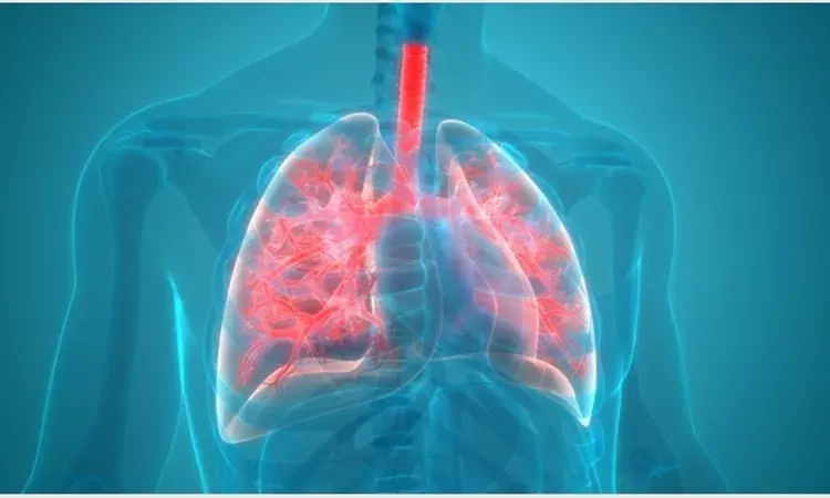 severe-pneumonia-acute-respiratory-infections