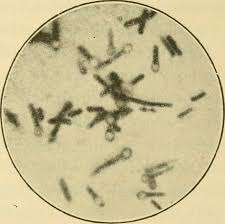 clostridium-tetani